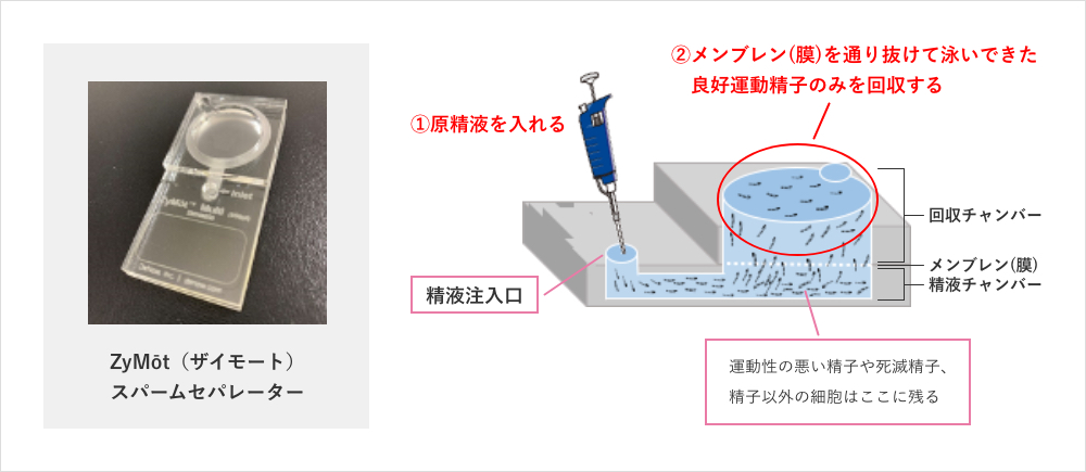 ザイモートイメージ