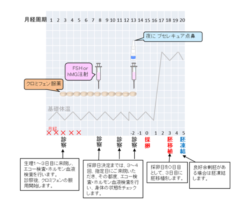 新・低刺激法プラン図解